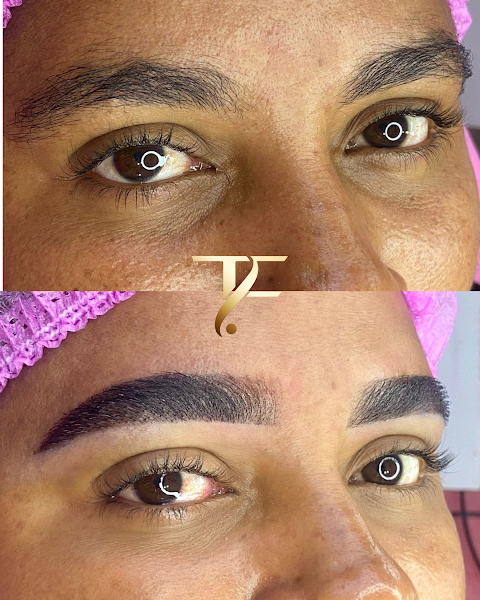 Foto 2 de Tayana Fonseca | Clínica de Estética