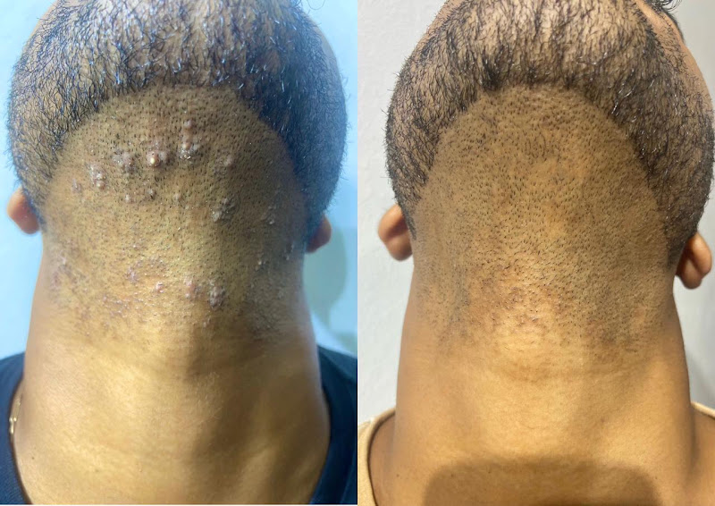 Foto 3 de Tayana Fonseca | Clínica de Estética