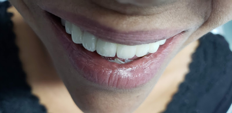 Foto 2 de TecLab - Solução em Prótese Dentária