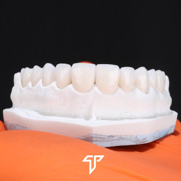 Foto 3 de Tedesco Odontologia - Implantes, Lentes de Contato e Estética Dental - São Paulo