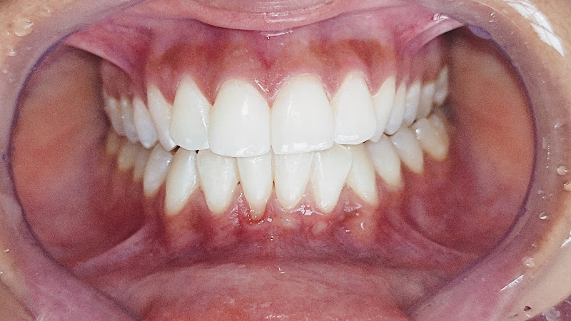 Foto 2 de Teles Odontologia – Aparelhos Ortodônticos e Implantes