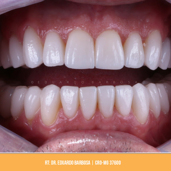 Foto 3 de Tempuz Odontologia e Bem Estar | Castelo/BH