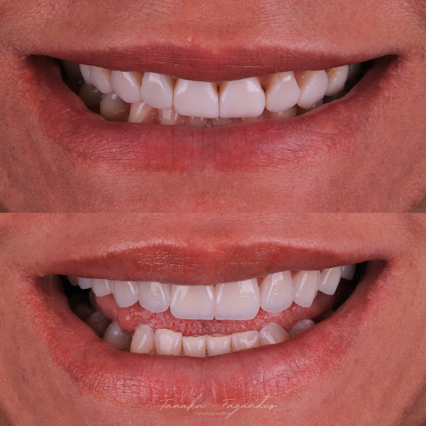 Foto 2 de TF Odontologia Estética