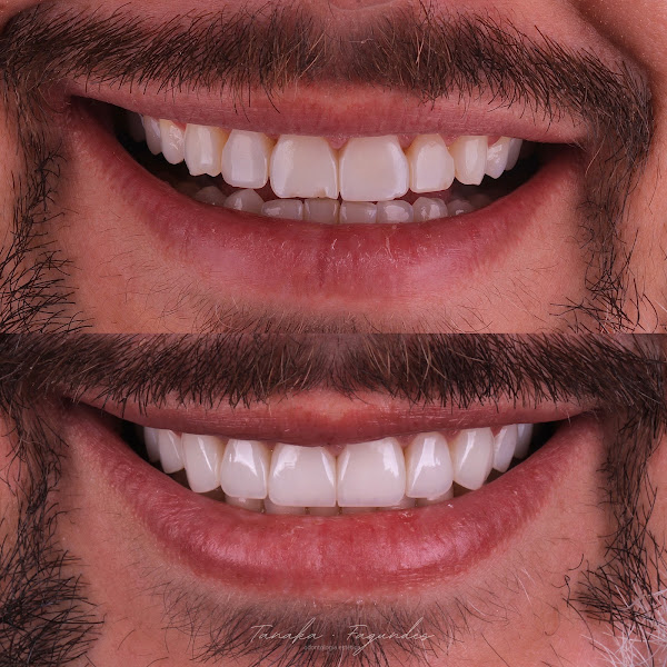 Foto 3 de TF Odontologia Estética