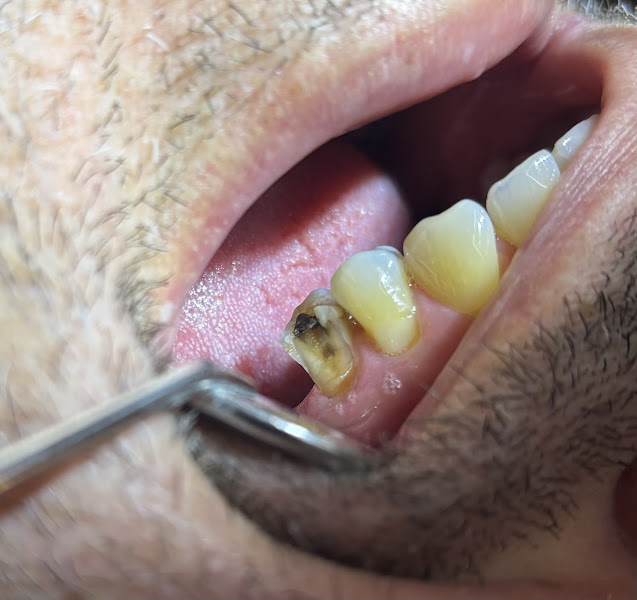 Foto 3 de Thais Rigo Implantodontia e Reabilitação Oral