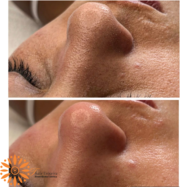 Foto 3 de Thaís Teixeira Estética Avançada Sudoeste: Harmonização Facial em Brasília DF