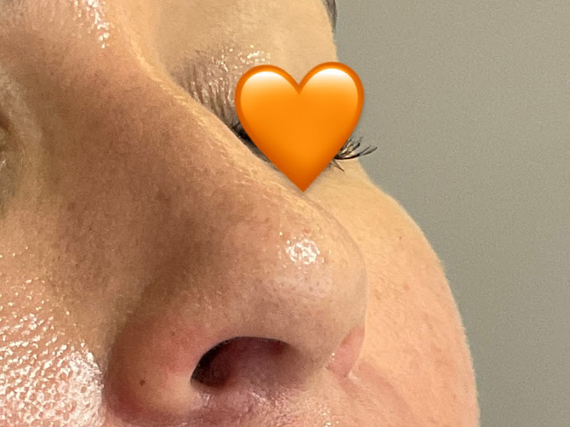 Foto 8 de Thaise Grisa | Periodontista | Especialista em Gengiva | Porto Alegre