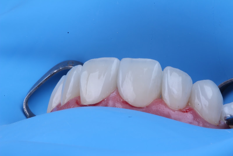 Foto 2 de Thássia Macedo Odontologia Especializada