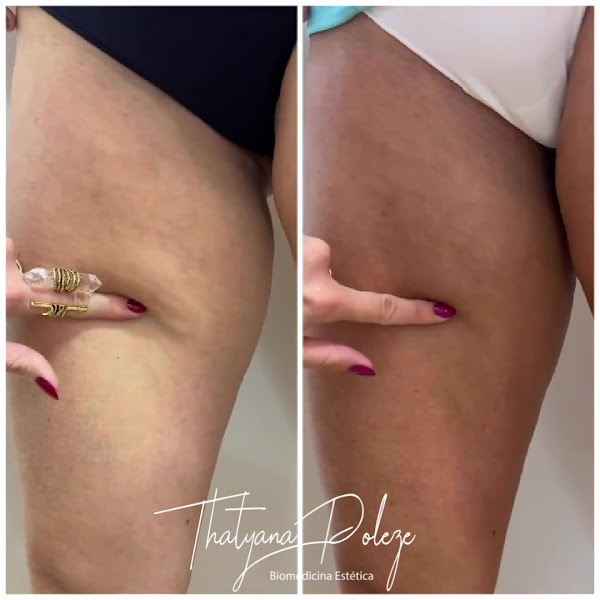 Foto 3 de Thatyana Poleze Biomedicina Estética