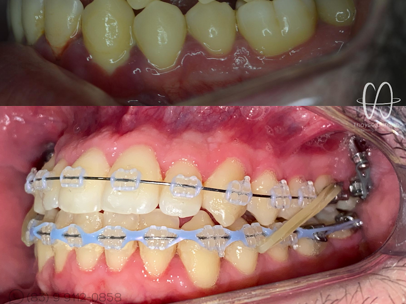 Foto 2 de Thayse Gonzaga Odontologia Especializada