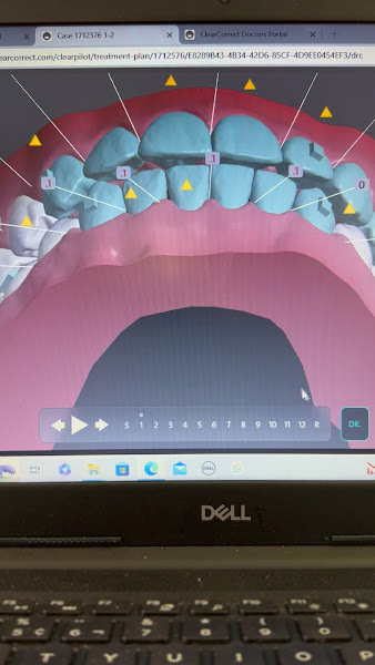 Foto 3 de Theo W. Hackbart - Ortodontia DIgital