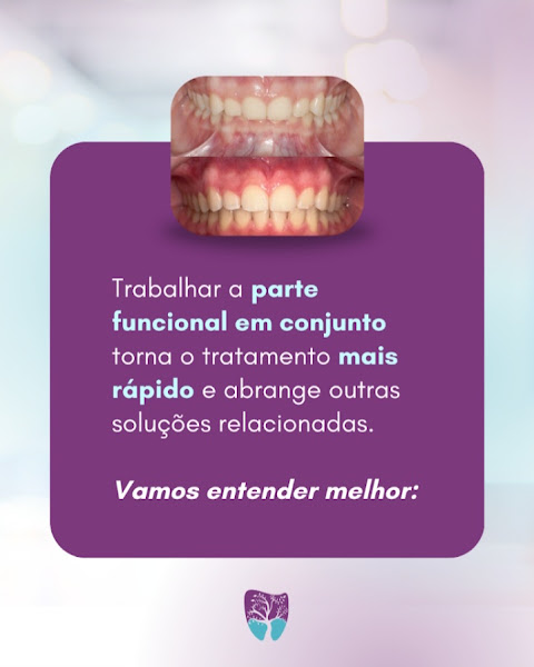 Foto 3 de Tiago Fadanelli Odontologia Miofuncional e Estética