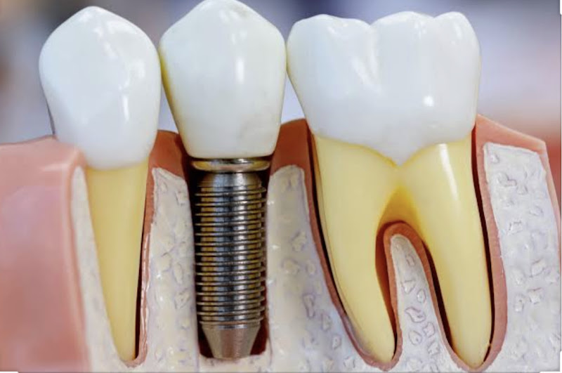 Foto 3 de Tiago Zambenedetti