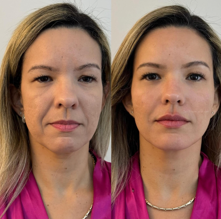 Foto 3 de Ticiane Henriques Clinique - Harmonização Facial e Rejuvenescimento