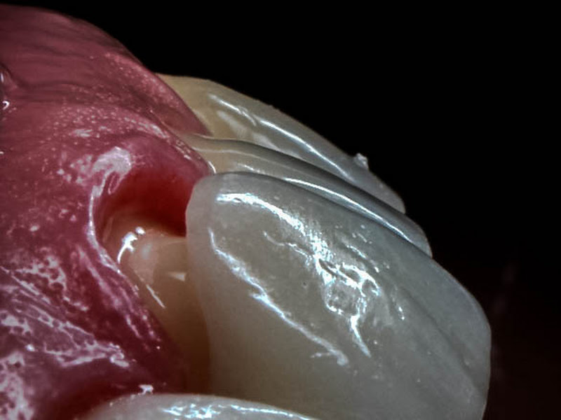 Foto 8 de Tissot Odontologia Especializada - Dentista em Balneário Camboriú