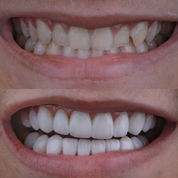 Foto 3 de TL CLINIC - Dra Thawany Lima | Odontologia Geral e Estética