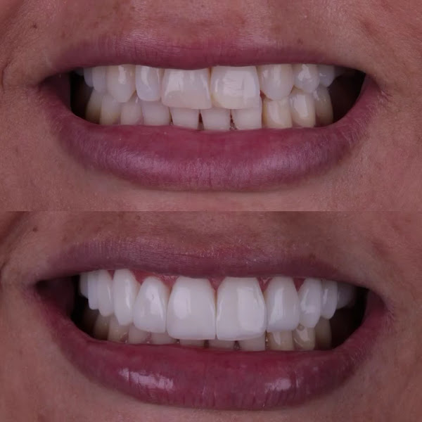 Foto 3 de TNB Odontologia e Harmonização Facial – Jaraguá