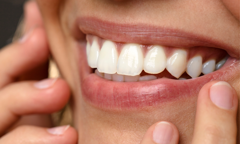 Foto 2 de Top Estética Bucal - Dentista em Bento Gonçalves