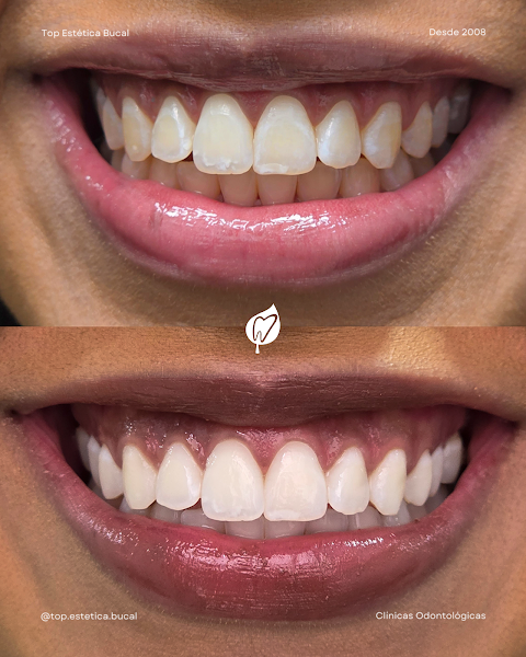 Foto 3 de Top Estética Bucal - Dentista em Bento Gonçalves