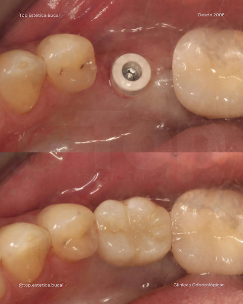 Foto 3 de Top Estética Bucal - Dentista em Caxias do Sul