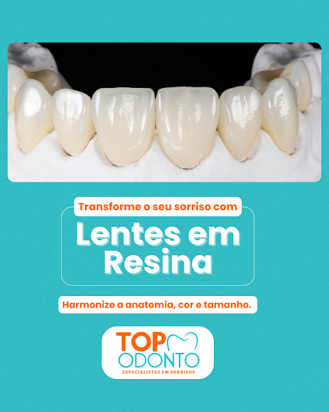 Foto 2 de Top Odonto Santarém