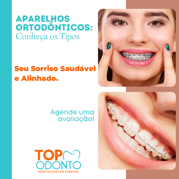 Foto 3 de Top Odonto Santarém