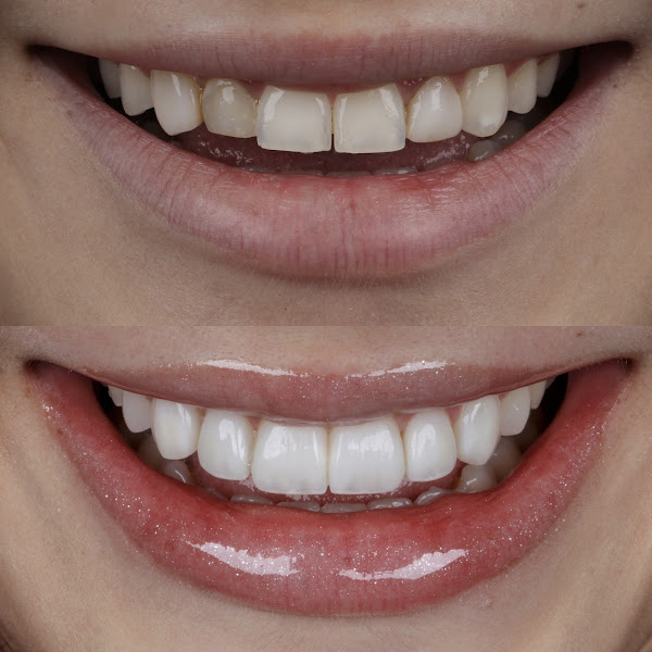 Foto 4 de TOP ODONTOLOGIA - Dentista Ponta Grossa