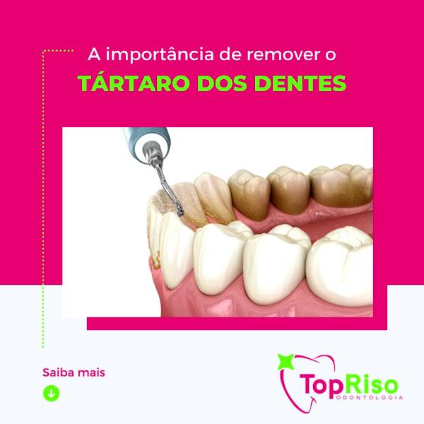 Foto 5 de TopRiso Odontologia