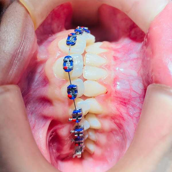 Foto 3 de Total Riso