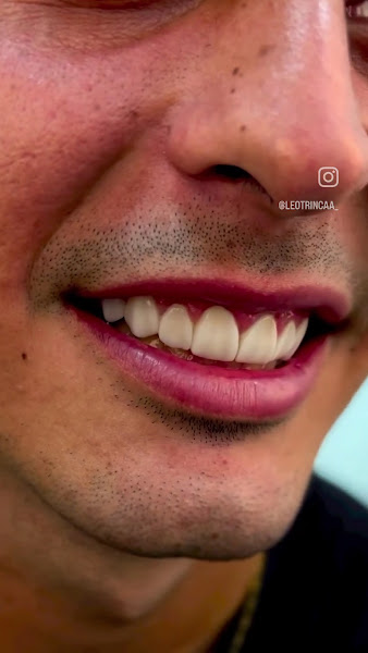 Foto 3 de Trinca Odontologia