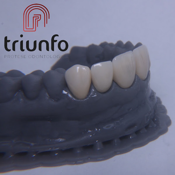 Foto 2 de Triunfo Laboratório de Próteses Dentárias Odontológicas