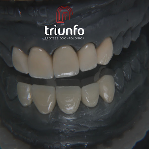 Foto 3 de Triunfo Laboratório de Próteses Dentárias Odontológicas
