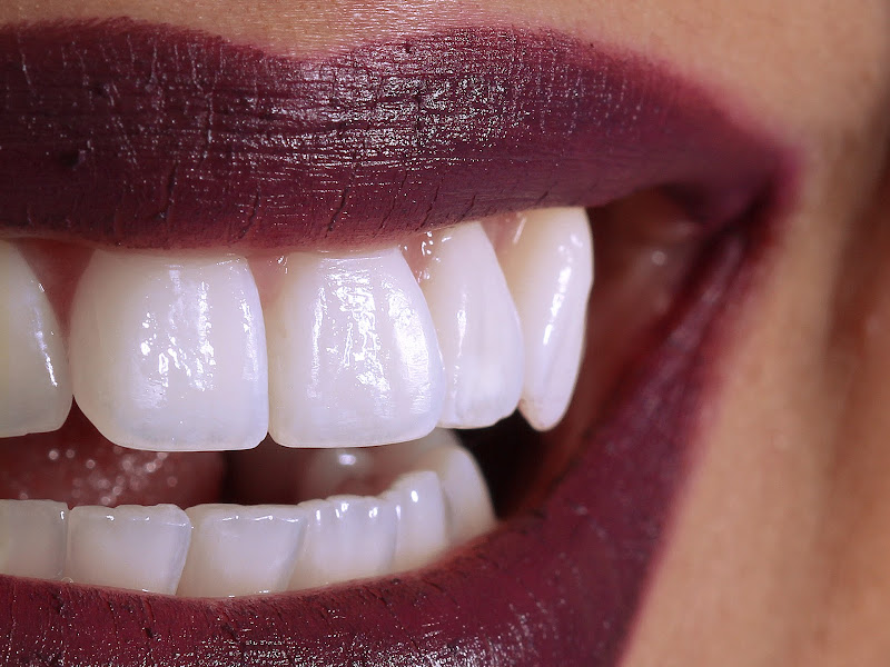 Foto 3 de Túlio Medeiros Danoski