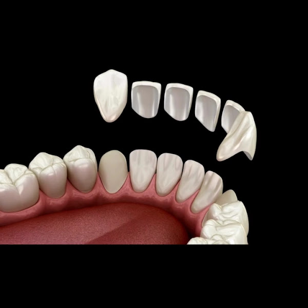 Foto 4 de Turk Odontologia - Dra. Néhida Turk