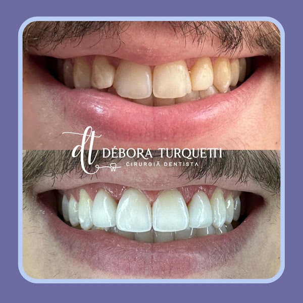 Foto 2 de TURQUETTI ODONTOLOGIA ESPECIALIZADA
