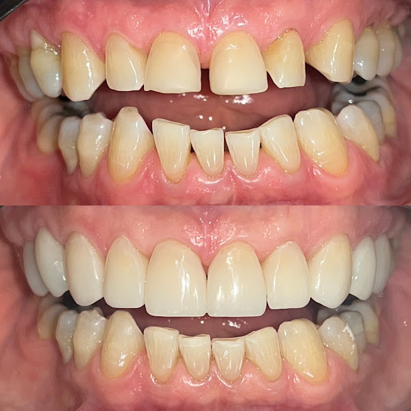 Foto 2 de Uchi Odontologia - Dr. Victor Uchikawa (dentro do Angeloni Itajaí)