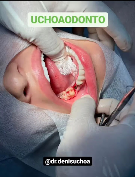 Foto 3 de UchoaOdonto