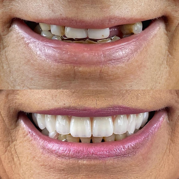 Foto de Ultra Odontologia Dr. Gabriel Demian