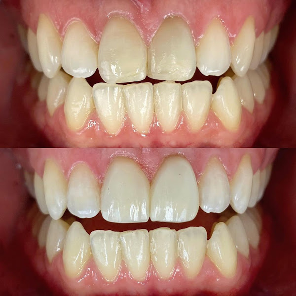 Foto 2 de Ultra Odontologia Parque Pinheiros