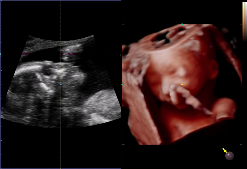 Foto 3 de Ultramed Ultrassonografias