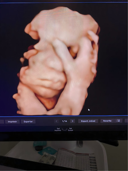 Foto 3 de Ultrassom Clinic