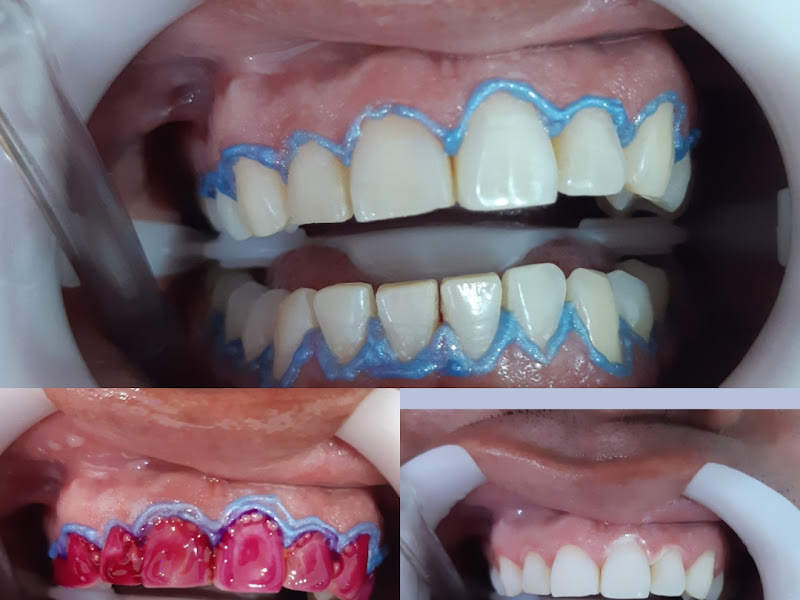 Foto 10 de Única Odontologia Lapa