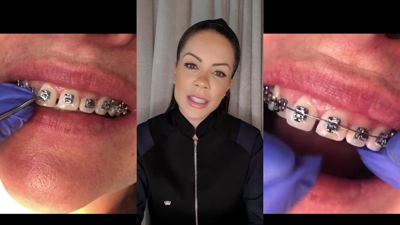 Foto 4 de Unica Odontologia Moderna Cascavel