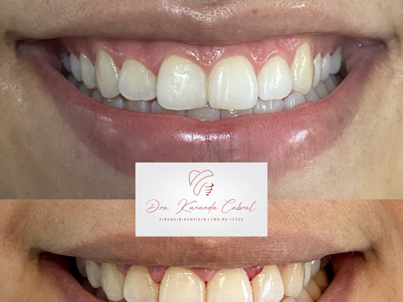 Foto 6 de Uniclin Odontologia Estética