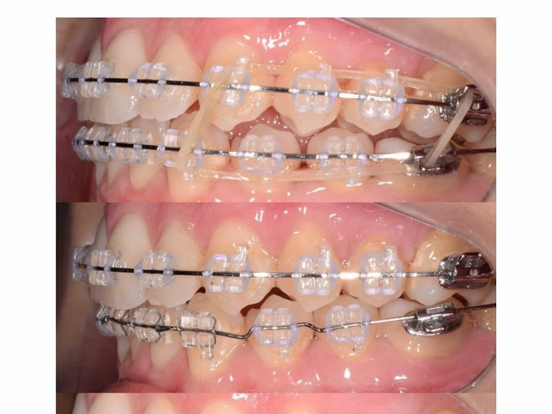 Foto 7 de Unidade Clínica Odontológica do Cesupa