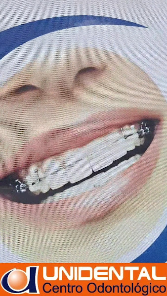 Foto 3 de Unidental, Campina Grande PB