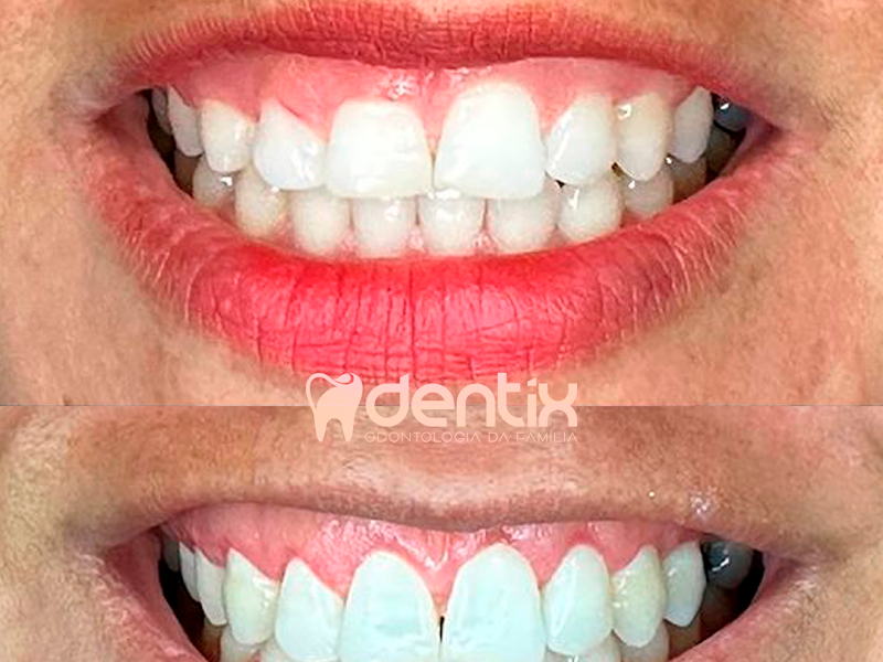 Foto 11 de Unidente Centro Odontológico | Petrolina | Unidade José e Maria