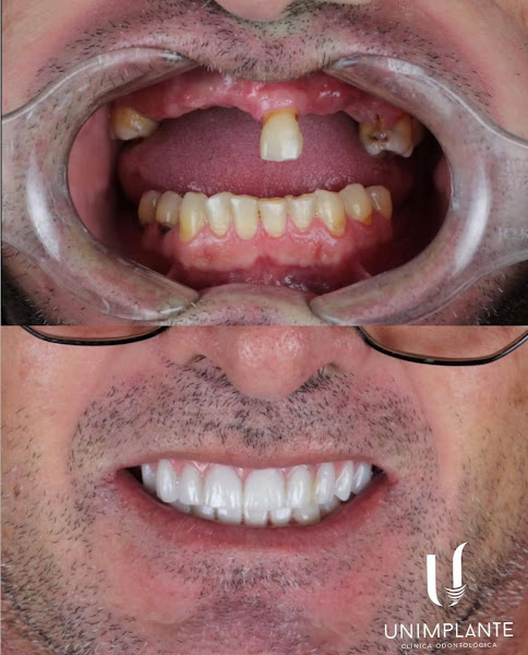 Foto 3 de Unimplante - Clínica Odontológica