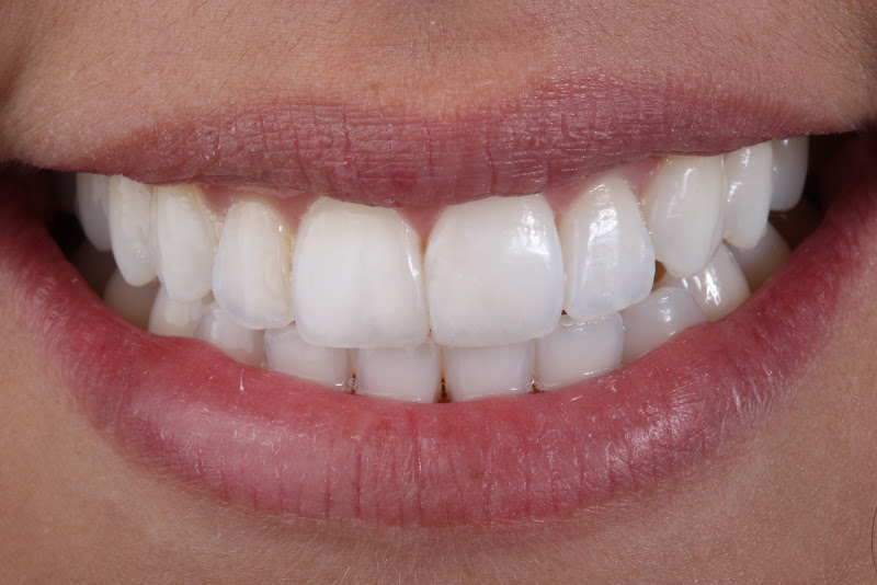 Foto 2 de Unno Odontologia Digital - Implantes em Juiz de Fora - MG