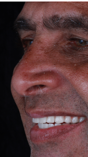 Foto 3 de Unno Odontologia Digital - Implantes em Juiz de Fora - MG